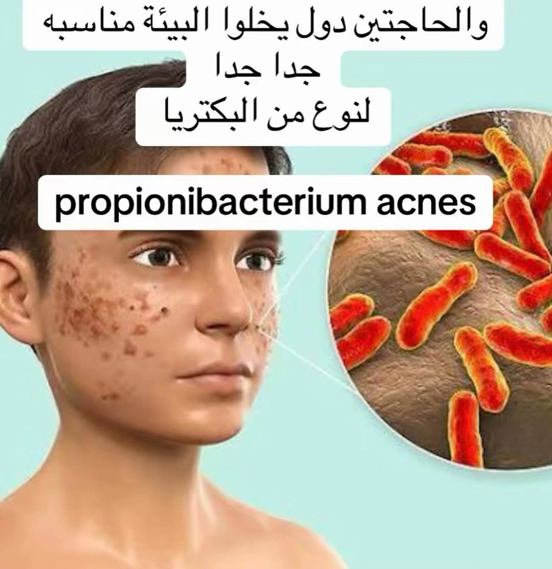 التهابات
