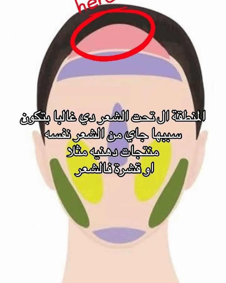 منطقة الخدود