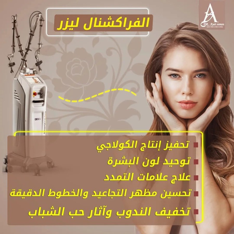 فراكشنال ليزر